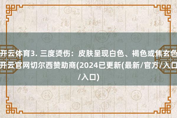 开云体育3. 三度烫伤：皮肤呈现白色、褐色或焦玄色-开云官网切尔西赞助商(2024已更新(最新/官方/入口)